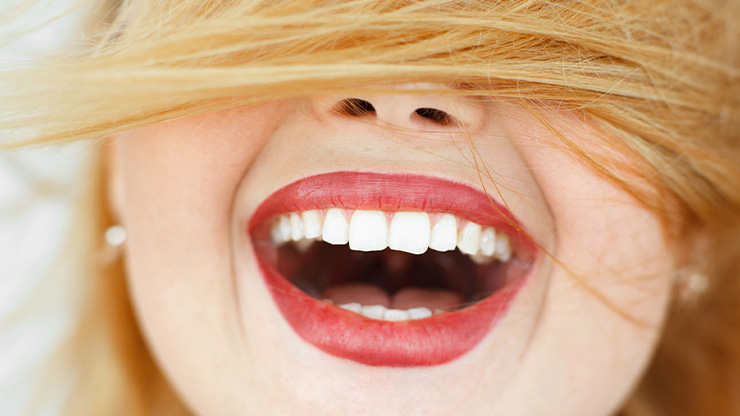 Bleaching & Veneers